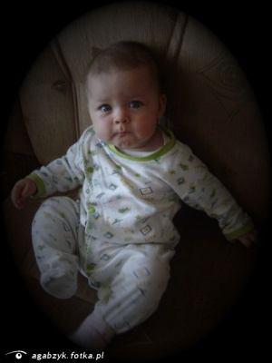 skin, person, baby, product