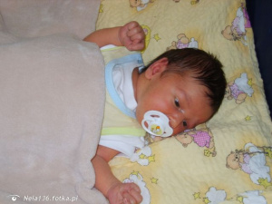 skin, person, baby, product