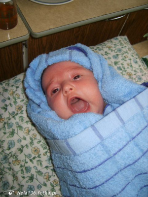 skin, person, baby, product