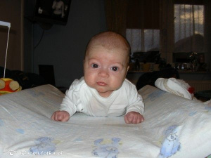 skin, person, baby