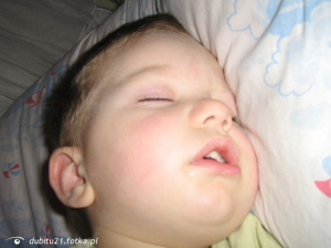 mouth, skin, ear, baby