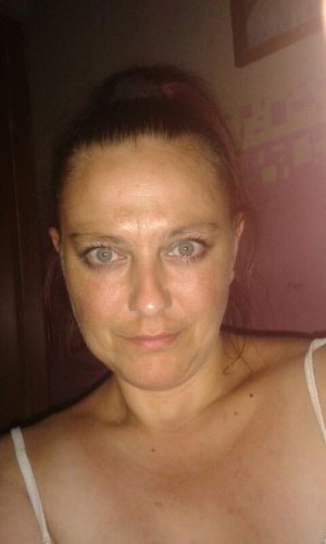 eyelash, skin, muscle