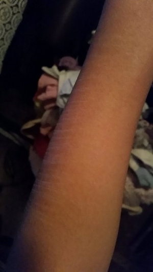 skin, muscle