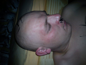 mouth, skin, muscle, ear