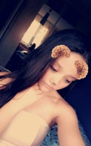 hair, skin