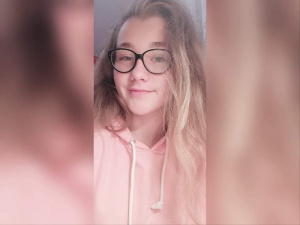 skin, glasses
