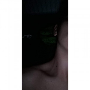 muscle