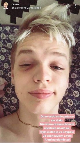 Najładniejsze zdjęcie użytkownika GolompH - 