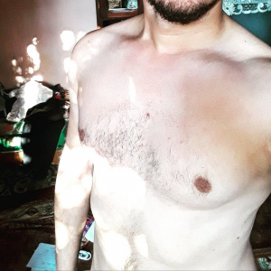 muscle