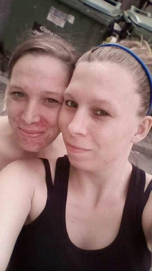 skin, selfie, fun, smile, ear
