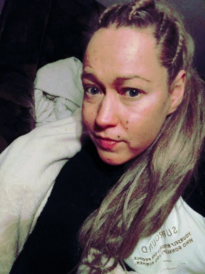 hair
