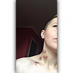 skin, ear