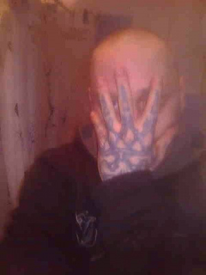 skin