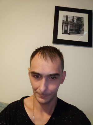 hair