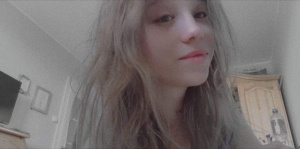 hair, skin