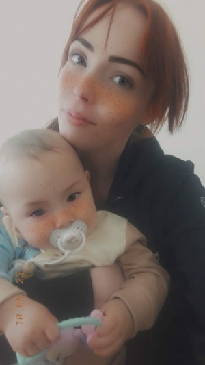skin, person, baby