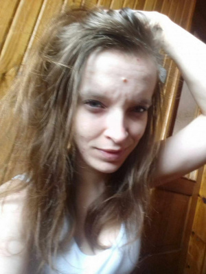hair