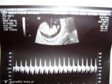 Fotos Izunia852