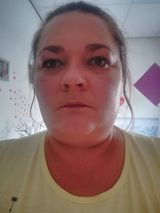 Fotos MiloszewskaChrab49