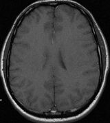 Photos NocowalemUKolegi