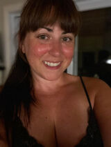 Photos afeezolamide56