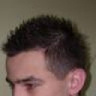 artix1992