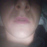 RadomD