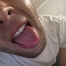 mocolol361